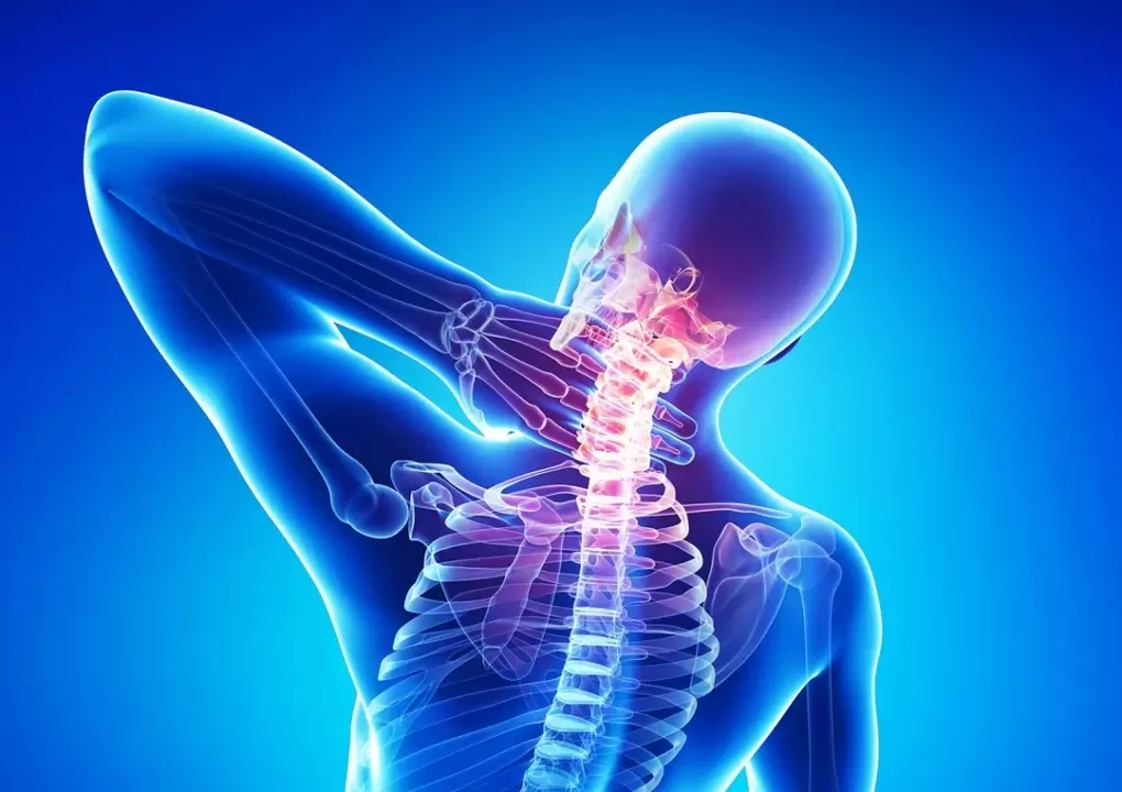osteocondroza este o boală a coloanei vertebrale