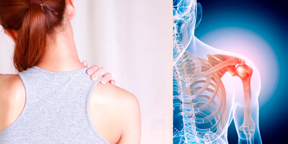 Dezvoltarea osteoartritei umărului duce treptat la durere constantă