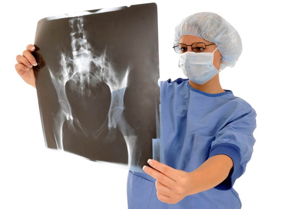 Radiografia articulației șoldului va ajuta medicul să determine cauza durerii