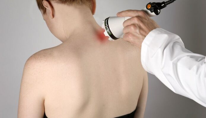 terapie cu laser pentru osteocondroza cervicală